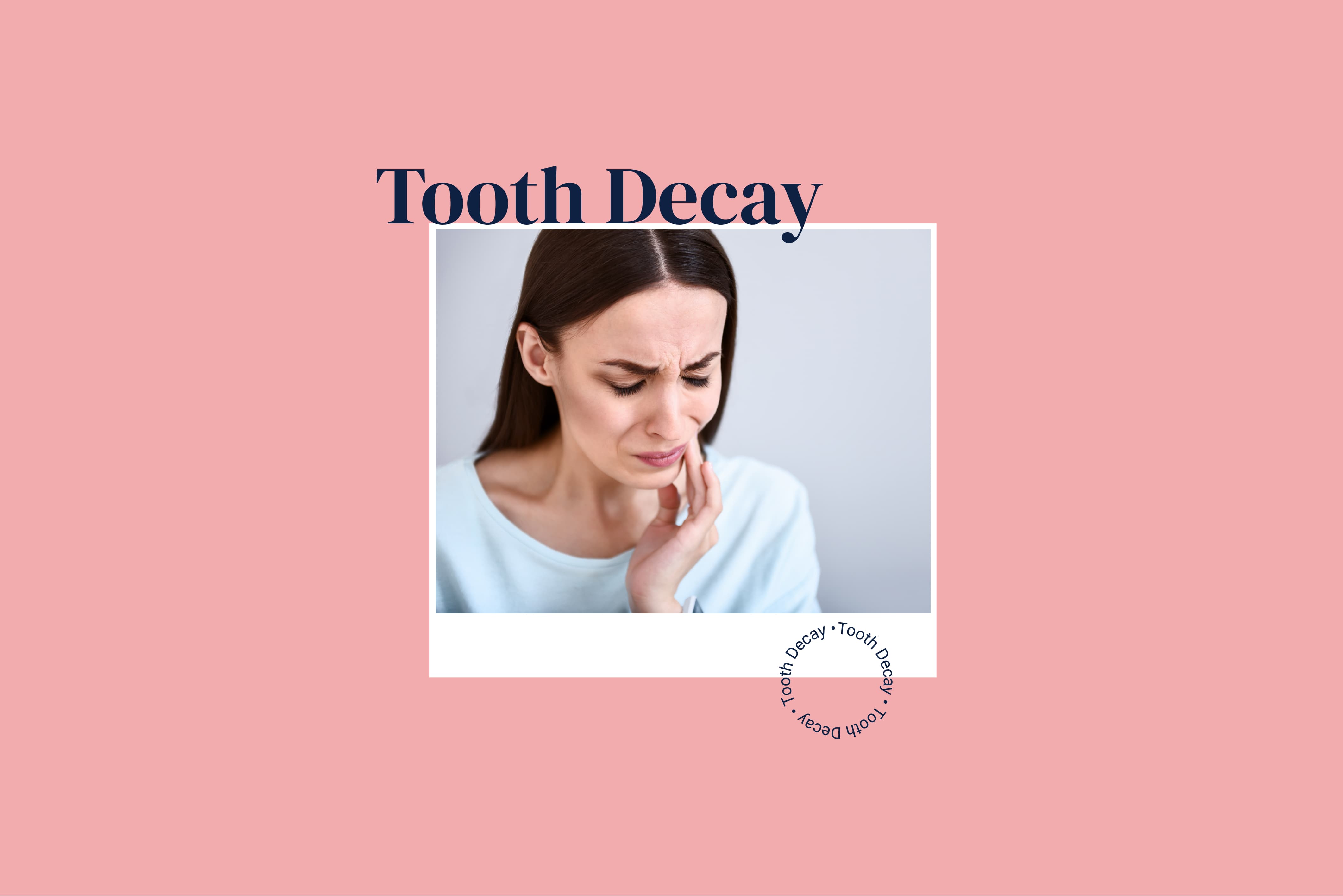 Trident Smiles Dental The various stages of tooth decay (with